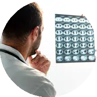 Opacifications