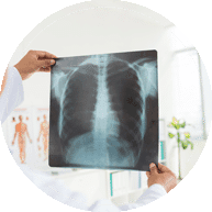 Radiographie