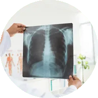 Radiographie