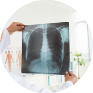 Radiographie